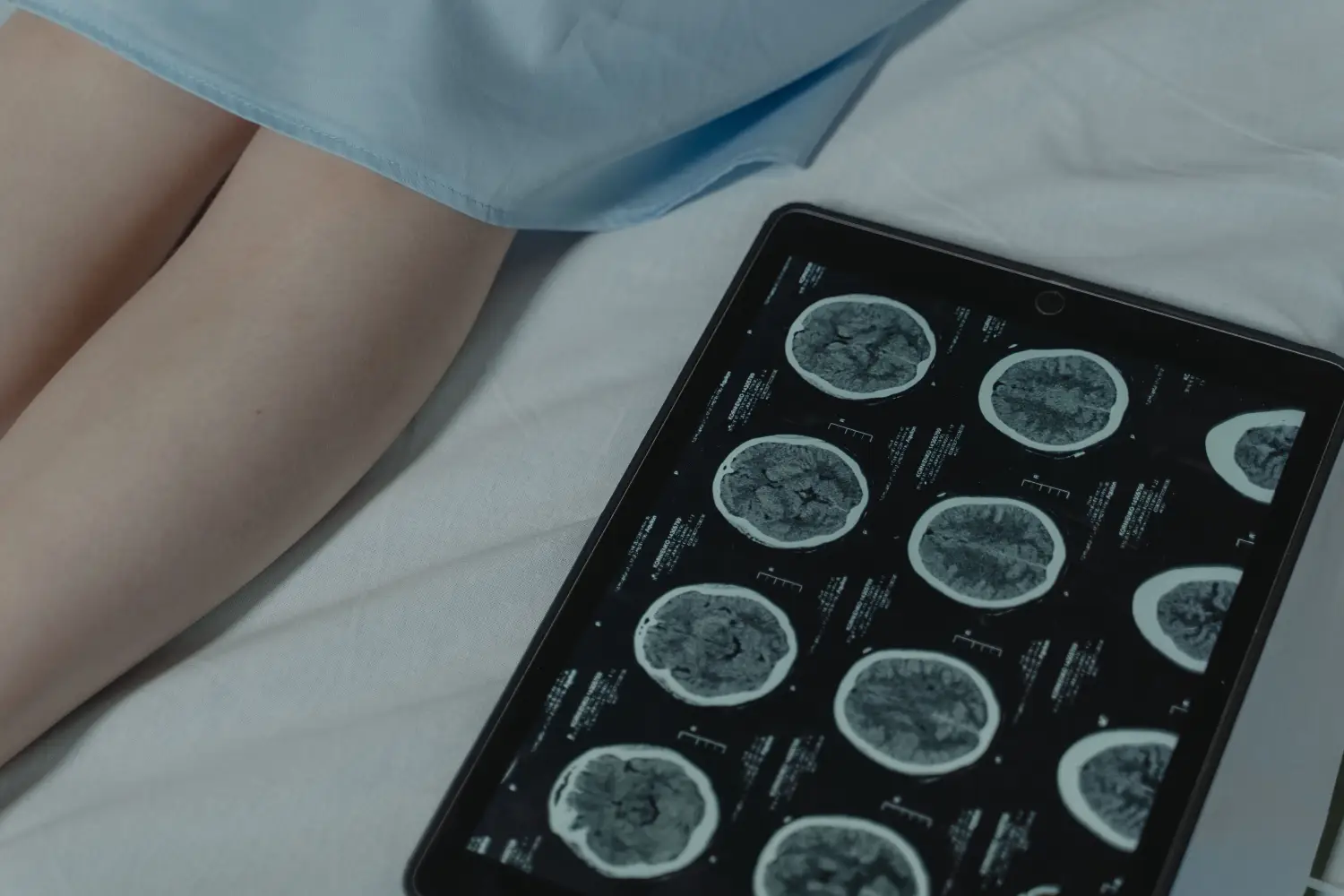 Pentingnya Pemeriksaan CT Scan untuk Deteksi Dini Penyakit